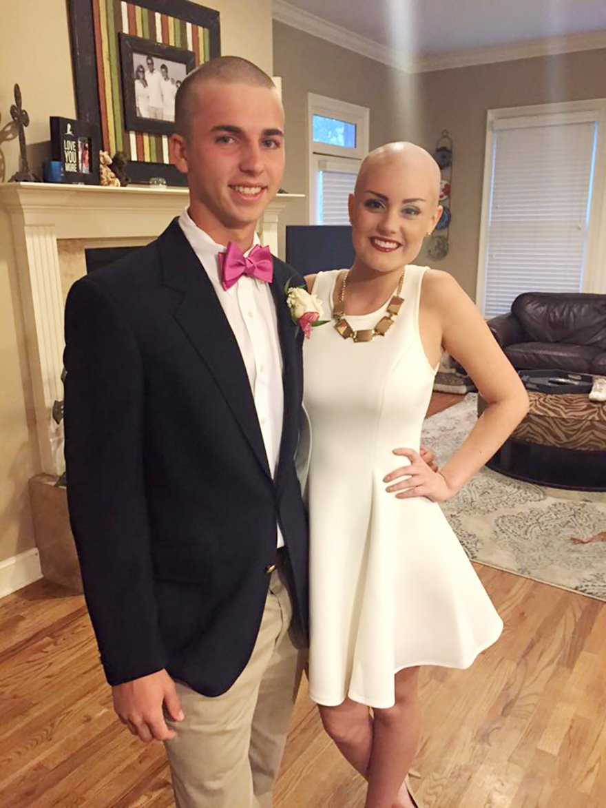 Brain cancer, allie allen, shaved head, brandon carpenter, cancer, breast cancer, motivation, inspirational, teenager, friend, disease, war against cancer