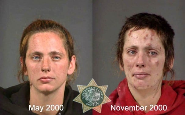 stop drug, drug, drug effect, drug abuse, molly, krokodil