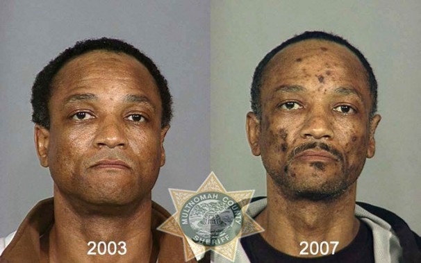 stop drug, drug, drug effect, drug abuse, molly, krokodil