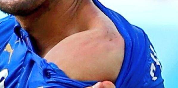 italy beaten by uruguay,uruguay beat italy,fifa2014,fifa world cup,luis suarez,chiellini,suarez bites chiellini,uruguay progress to pre-quaterfinals,suarez ban,disgraceful suarez