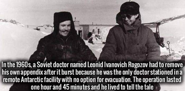 Dr. Leonid Ivanovich Rogozov- A Russian removed his own appendix
