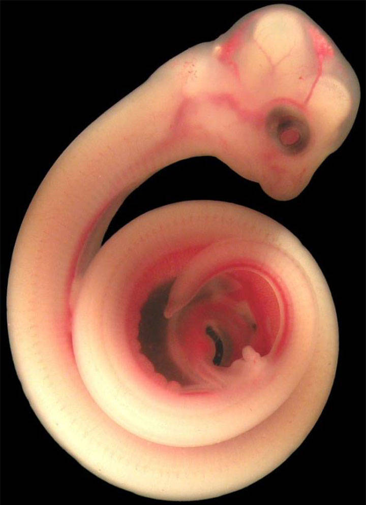 Snakes in womb