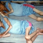 North-Korean-children-starving-in-famine
