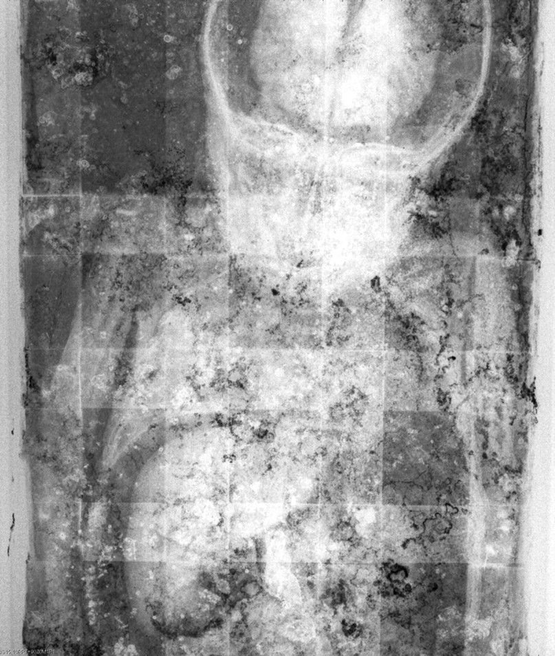rosalia lombardo eyes open, rosalia lombardo eyes open and close, rosalia lombardo time lapse, otzi the iceman, rosalia lombardo parents tollund man, bernadette soubirous, rosalia lombardo decomposing, rosalia lombardo, mummy, best mummy, child mummy, Italian child, italy, omg, wtf, secret of rosalia lombardo, girls mummy