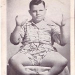 Tragic Tale of Lobster Boy