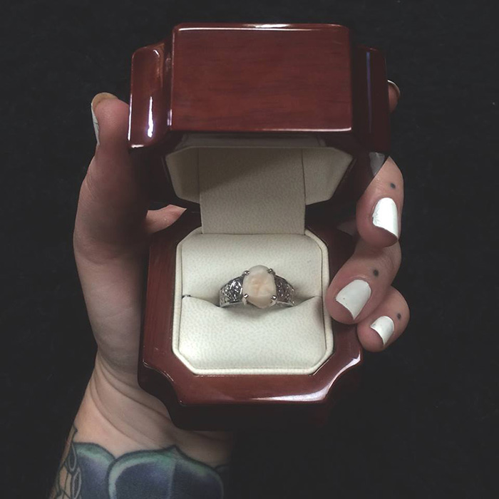 wisdom tooth, engagement, ring, fiance, carlee leifkes, lucas unger,  weird engagement ring, engagement idea, proposal, amazing, weird, couple, facebook