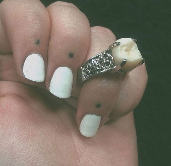 Wisdom tooth, engagement, ring, fiance, carlee leifkes, lucas unger,  weird engagement ring, engagement idea, proposal, amazing, weird, couple, facebookc