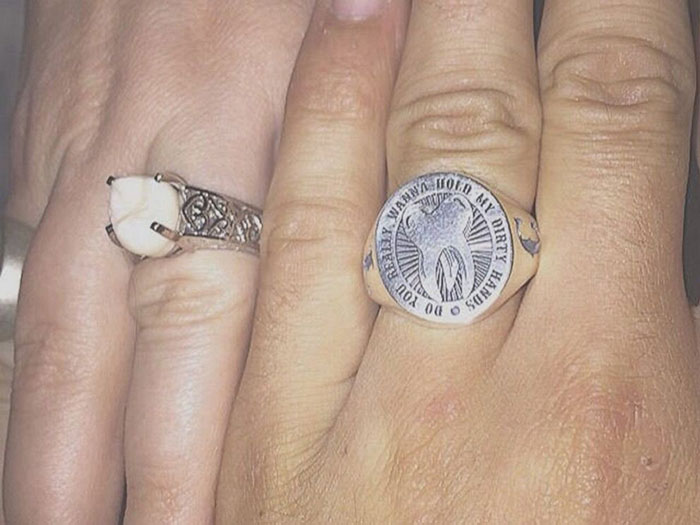 wisdom tooth, engagement, ring, fiance, carlee leifkes, lucas unger,  weird engagement ring, engagement idea, proposal, amazing, weird, couple, facebook