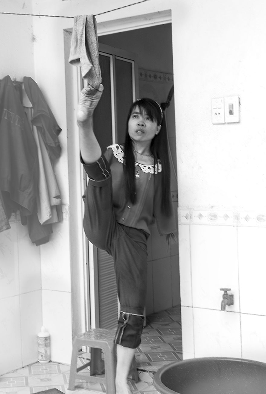 Vietnamese Girl, Nguyet, Vietnam, photography, girl without arm, war, agent orange, toxic chemicals, Nguyen Vu Phuoc, motivational, inspiring, bad effect