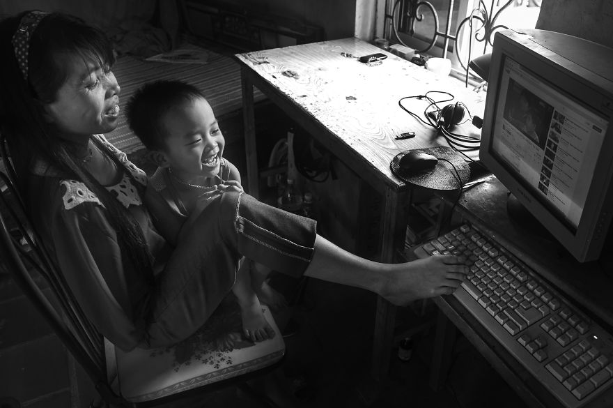 Vietnamese Girl, Nguyet, Vietnam, photography, girl without arm, war, agent orange, toxic chemicals, Nguyen Vu Phuoc, motivational, inspiring, bad effect