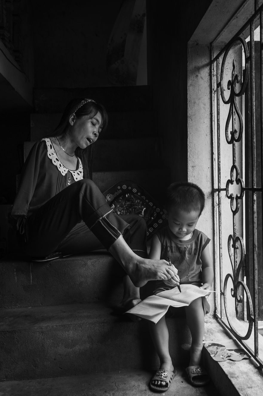 Vietnamese Girl, Nguyet, Vietnam, photography, girl without arm, war, agent orange, toxic chemicals, Nguyen Vu Phuoc, motivational, inspiring, bad effect