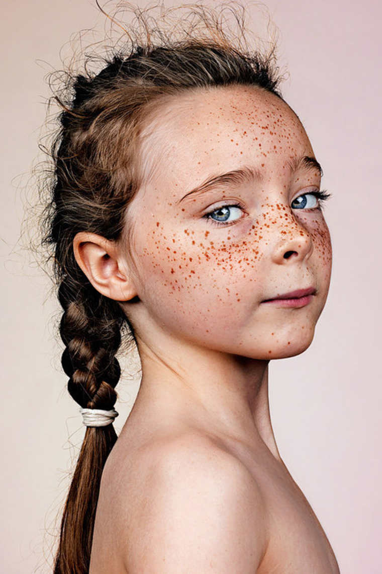 18 Striking Portraits Of Freckled People By British Photographer