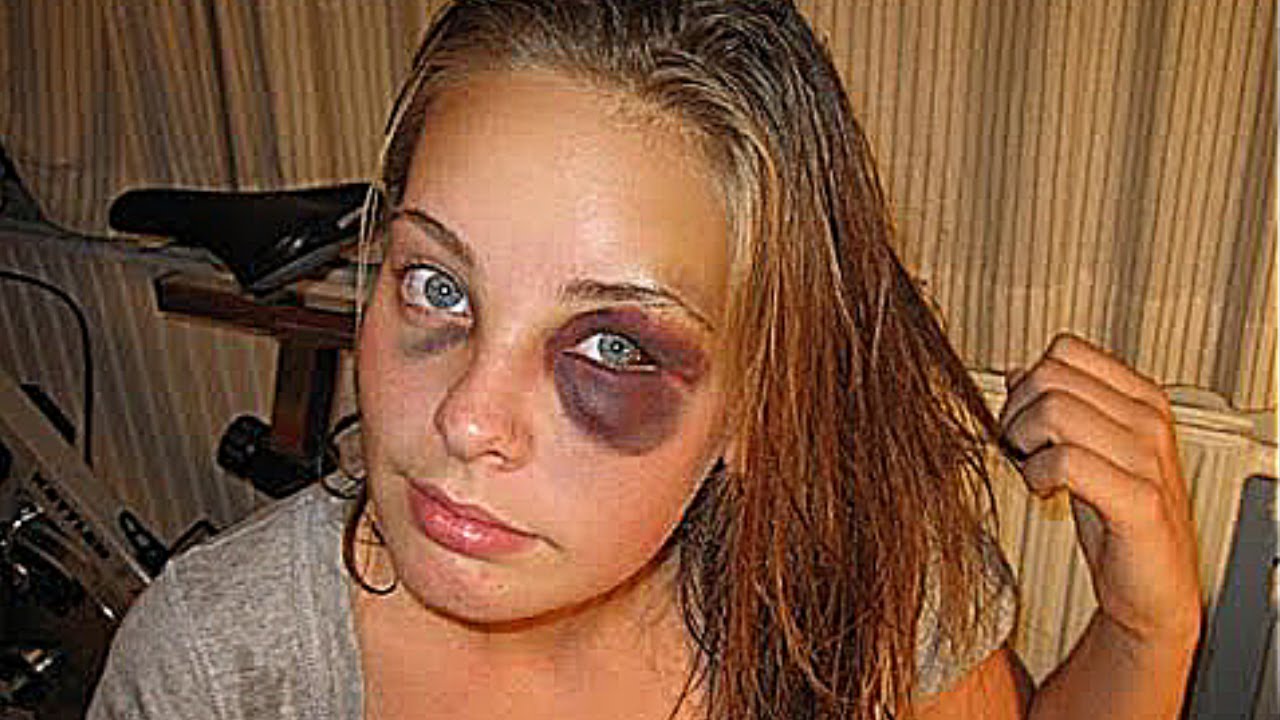 women, physical abuse, women abuse, abused women