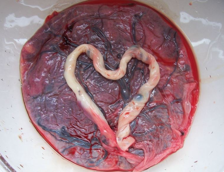 eating baby placenta, mothers eat their own placenta