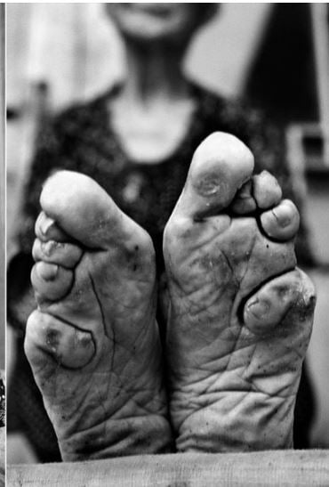 Rituals in china, binding feet of young girls, chinese superstition