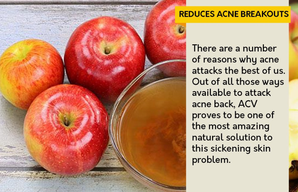Benefits of apple cider vinegar 3 | reckon talk