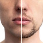 men glow facial las vegas