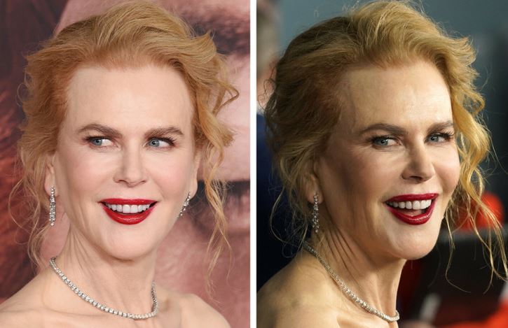 Nicole kidman